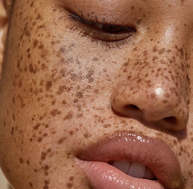 Glow Expert skin treatments for face